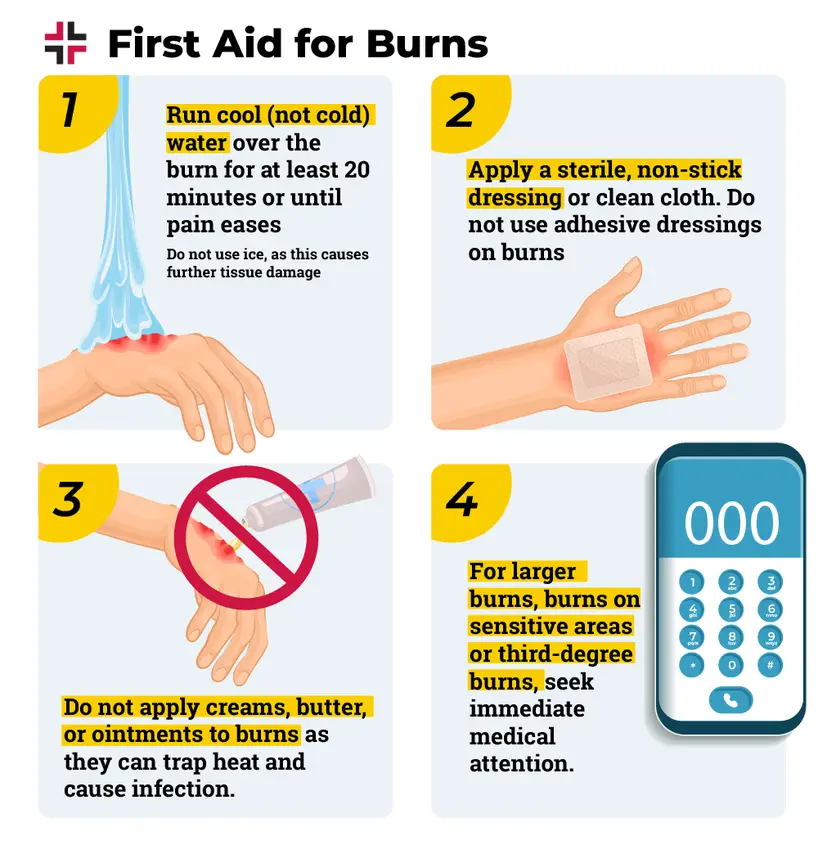 Burns